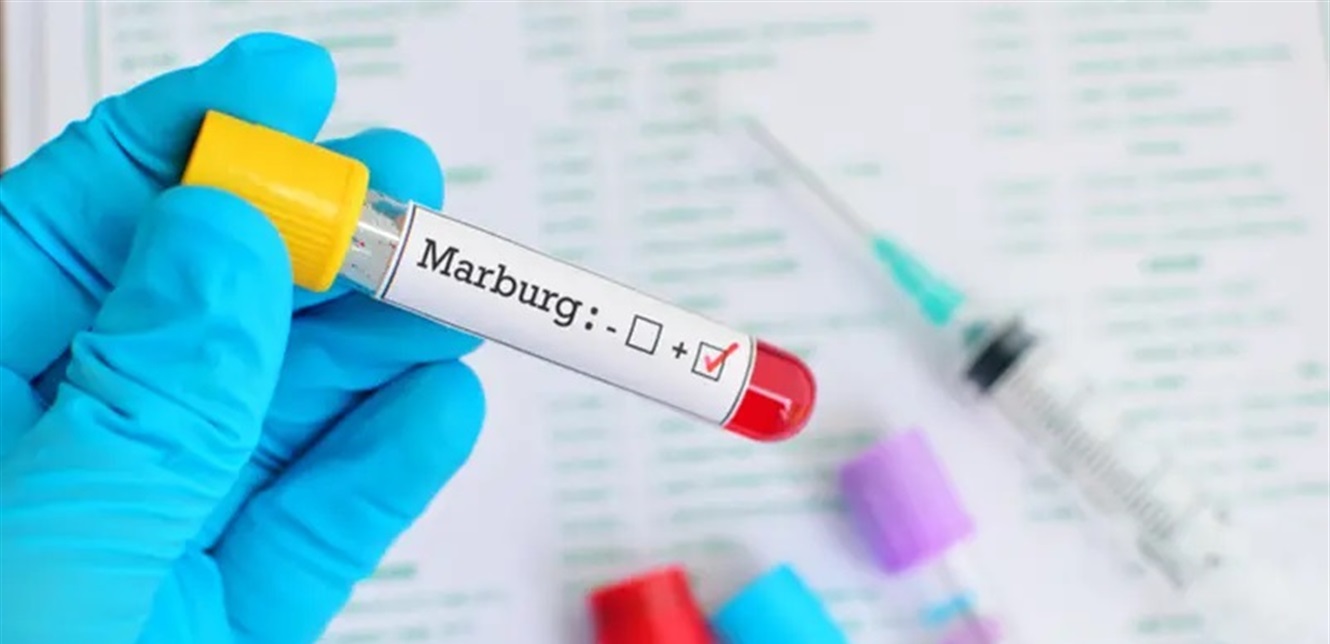 Skin rash and bleeding… An Arab country warns of the deadly Marburg virus