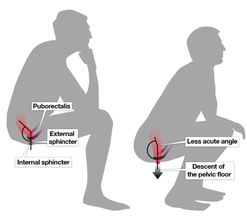 squat-vs-sit.jpg.860x0_q70_crop-smart-63